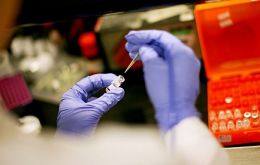 Athletes will be tested on samples of hair